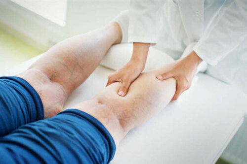 Interventional Treatment