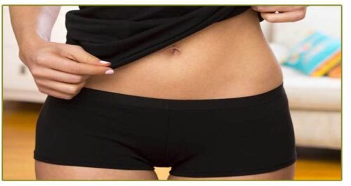 Vulvar Varicosities