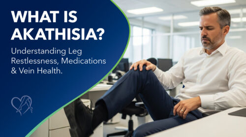 Center for vein restoration What Is Akathisia Thumbnail