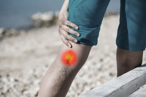 Leg with bulging veins and pain illustration