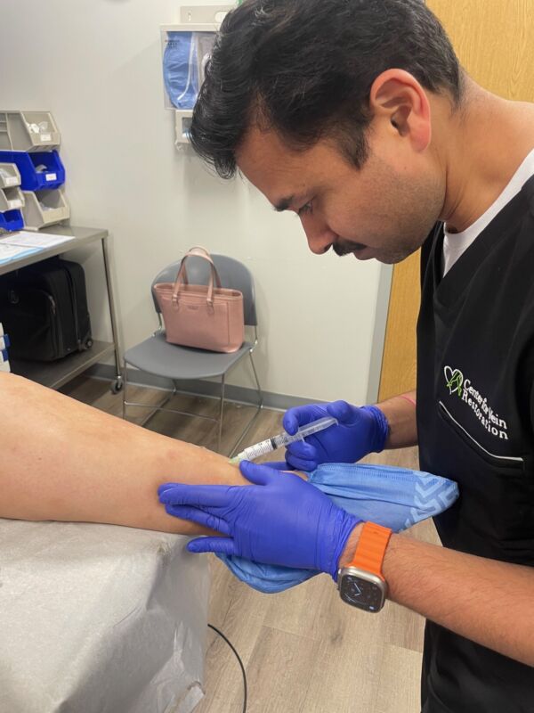 vein treatment