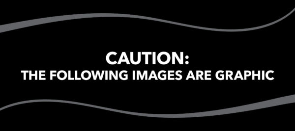 Blog Image How to Tell the Difference Between Types of Leg Wounds Blog Slider 1