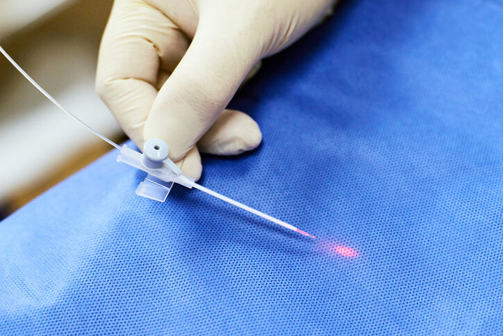 Laser removal veins