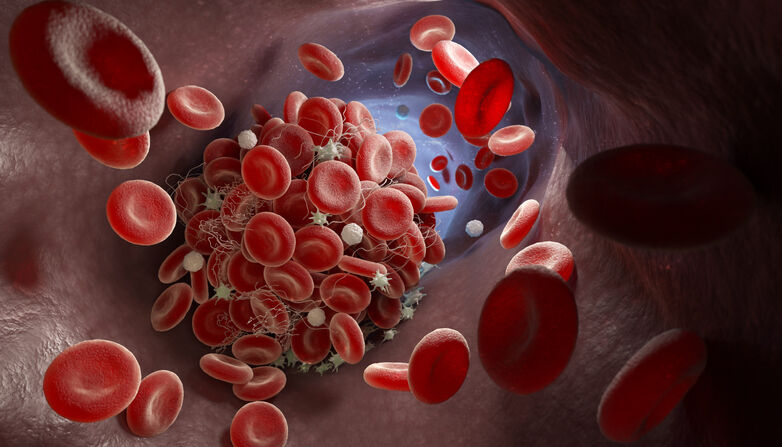 Formation of a blood clot