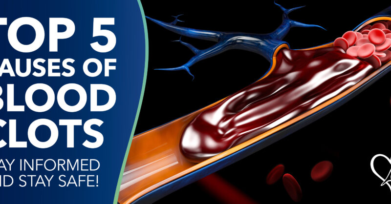 Top 5 Causes of Blood Clots: Stay Informed and Stay Safe!
