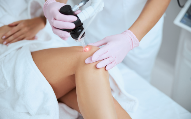 Top Spider and Varicose Veins Treatments A Guide from Expert Vein Doctors