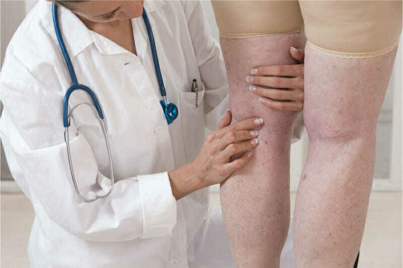 doctor consultation for veins