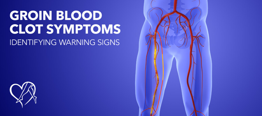Blog Image Groin Blood Clot Symptoms