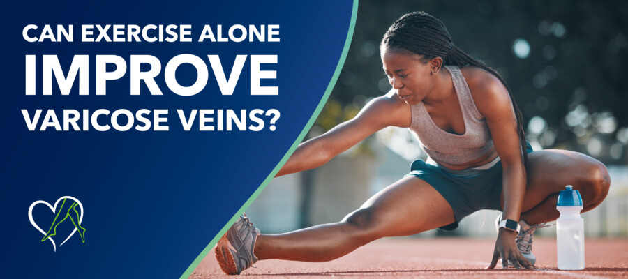 Blog Can Exercise Alone Improve Varicose Veins
