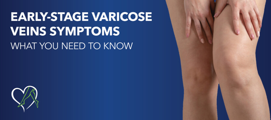 Blog Early Stage Vein Symptoms
