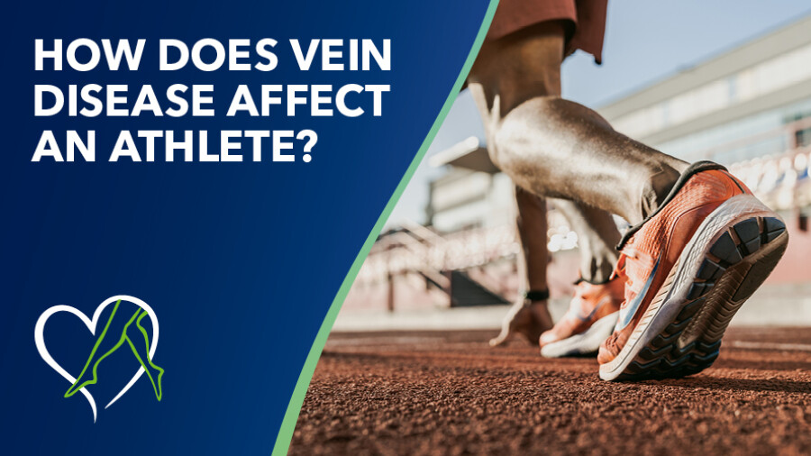 Blog How Does Vein Disease Affect Athlete