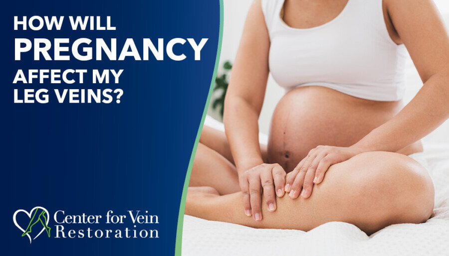 Blog How Will Pregnancy Affect Leg Veins