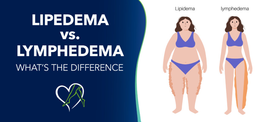 Blog Lipidema v Lymphedema Whats The Difference