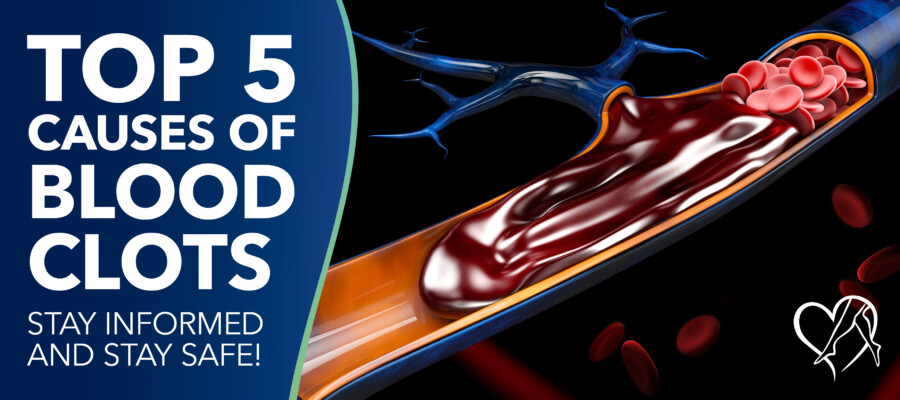 Blog Top5 Causes Of Blood Clots