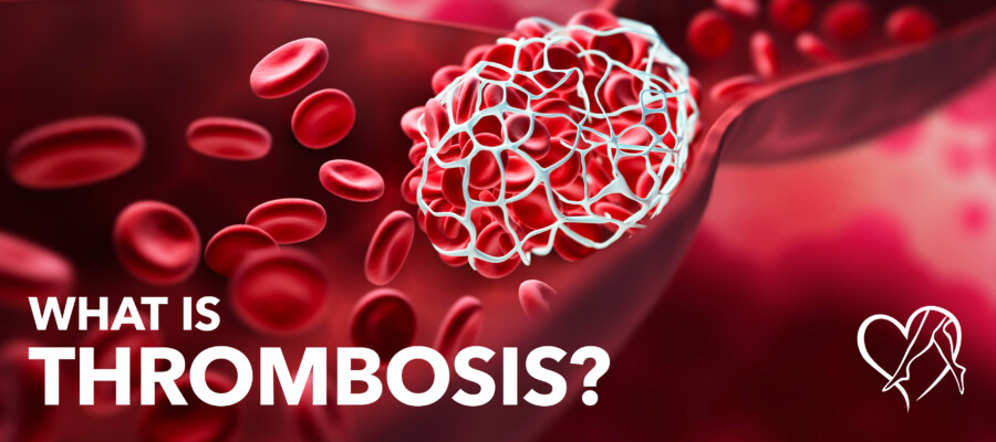 Blog What Is Thrombosis 1