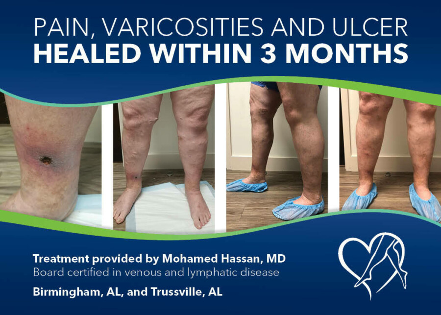 Louis Blog Image Dr Hassan Patient Story Wound Progression 012423