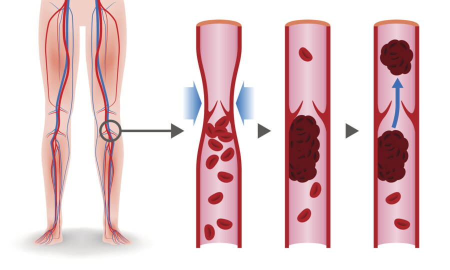 Blood flow legs veins