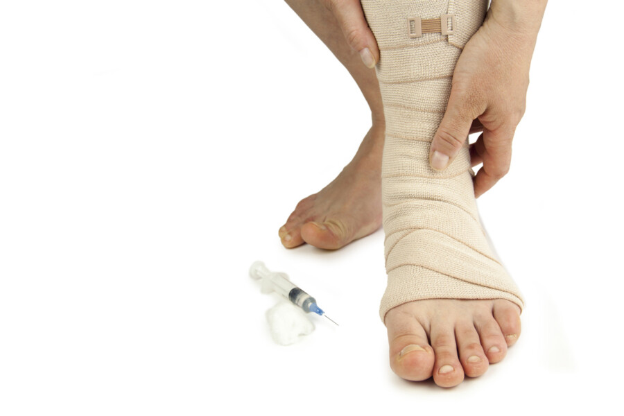 Compression stockings leg vein heal