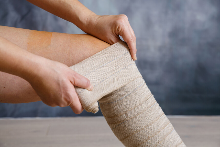 Arterial Ulcer vs. Venous Ulcer: What’s the Difference?
