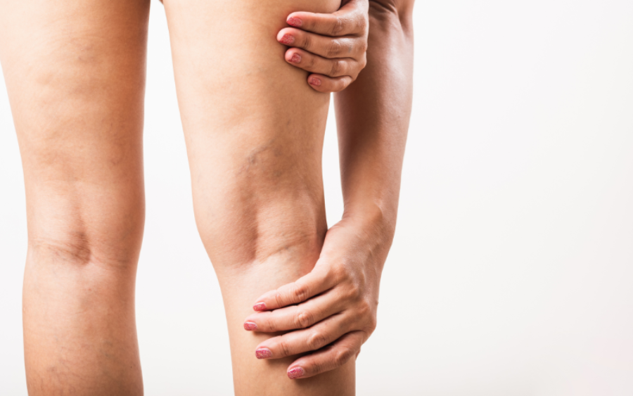 Is your leg pain linked to vein disease