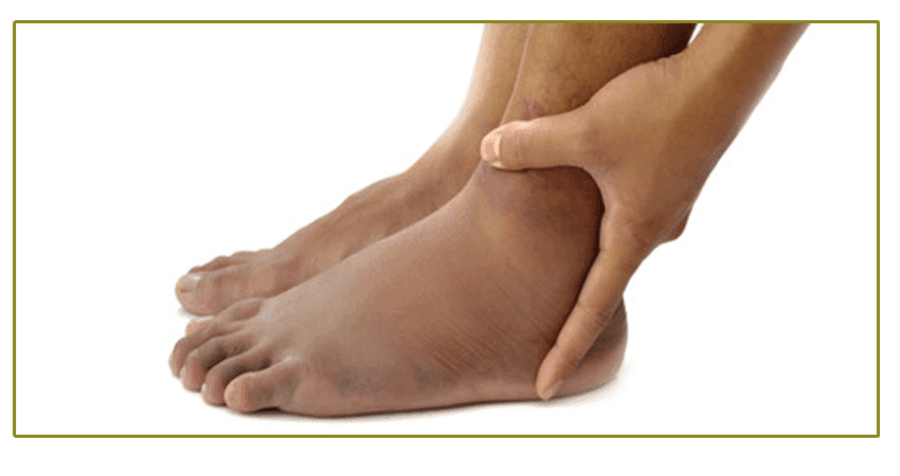 What's Behind Swollen Feet and Ankles?