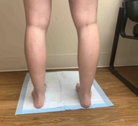 BEFORE AFTER EMILY KOTCH A