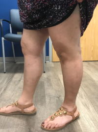 Mrn 259206 post op