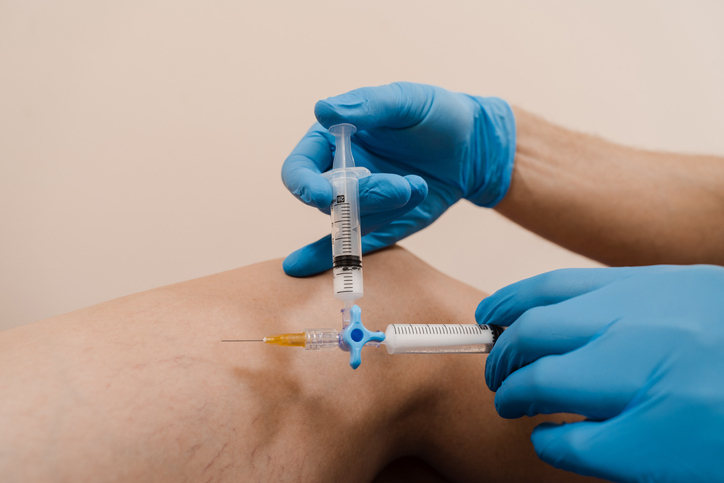 Sclerotherapy injecting