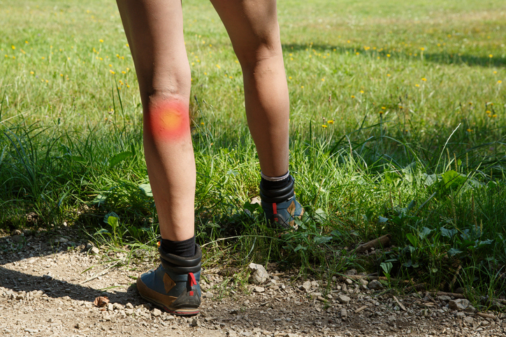 Woman standing on grass with a sore leg